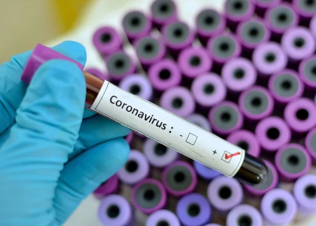 Куда госпитализируют запорожцев в случае заражения коронавирусом