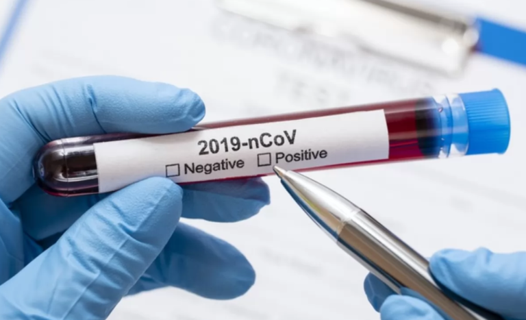 Тесты на коронавирус в Запорожье ожидаются в ближайшие дни