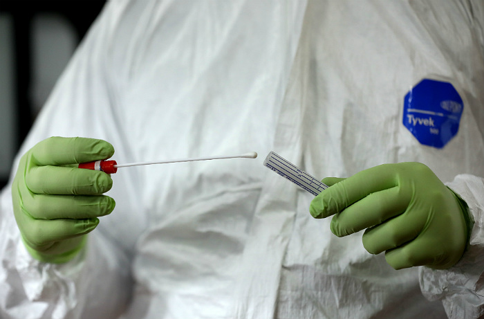 В Запорожье доставят тест-системы для выявления коронавируса