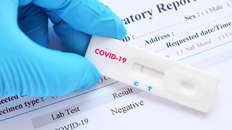 Когда в Украине внедрят ИФА-тесты на наличие антител к COVID-19 