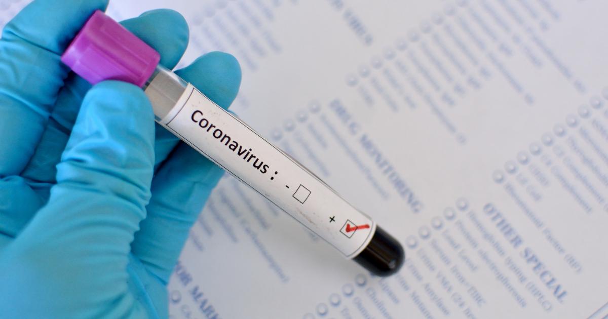 В Запорожье у супружеской пары подтвердился коронавирус