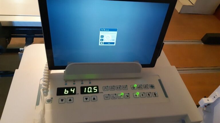 В Запорожье 6-я больница получила современное оборудование для диагностики пневмонии 