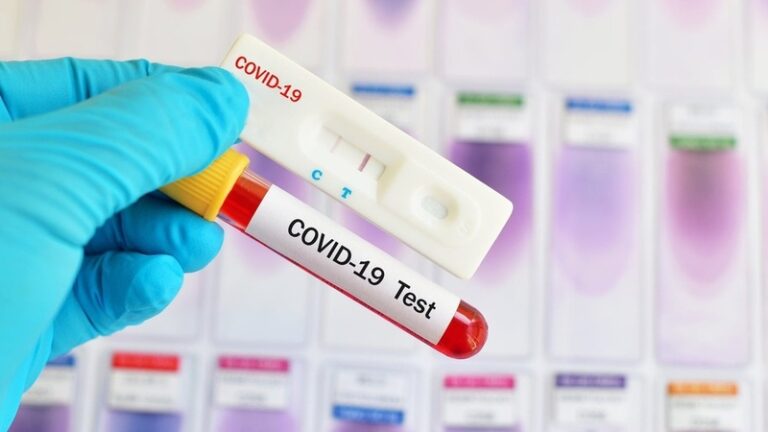 В Запорожской области обнаружили новые случаи заражения коронавирусом