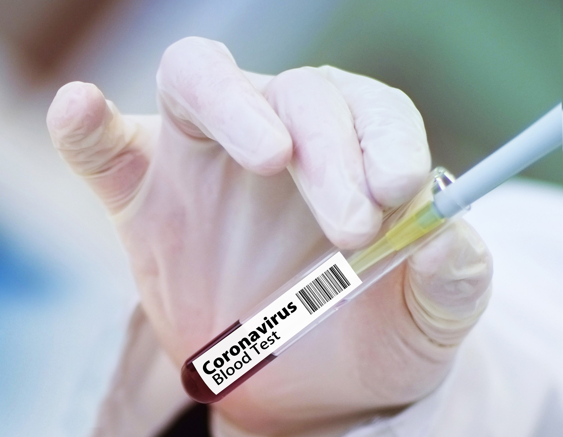 В Запорожской области 496 случаев заболевания коронавирусом COVID-19
