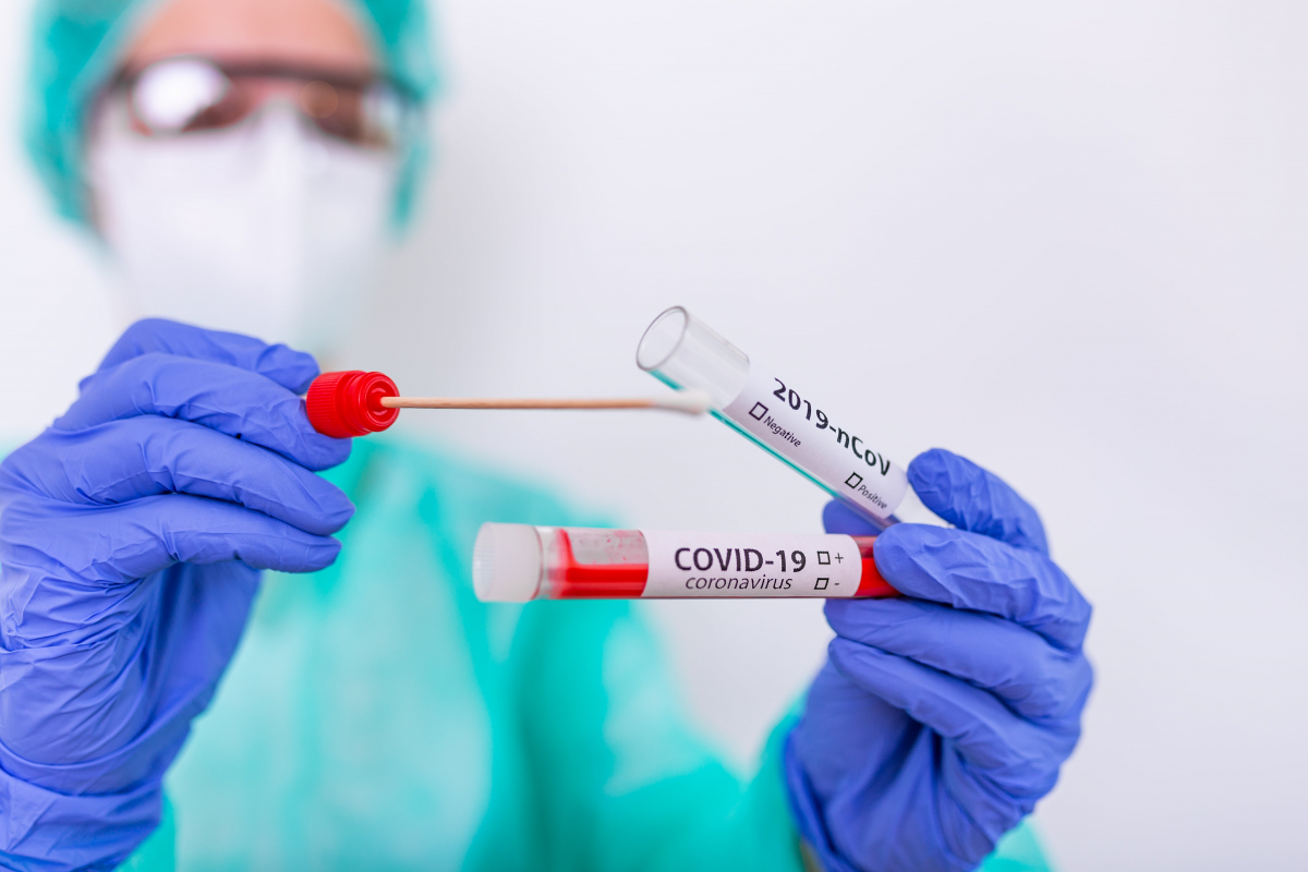 В Запорожье коронавирус подтвердился еще у 113 человек