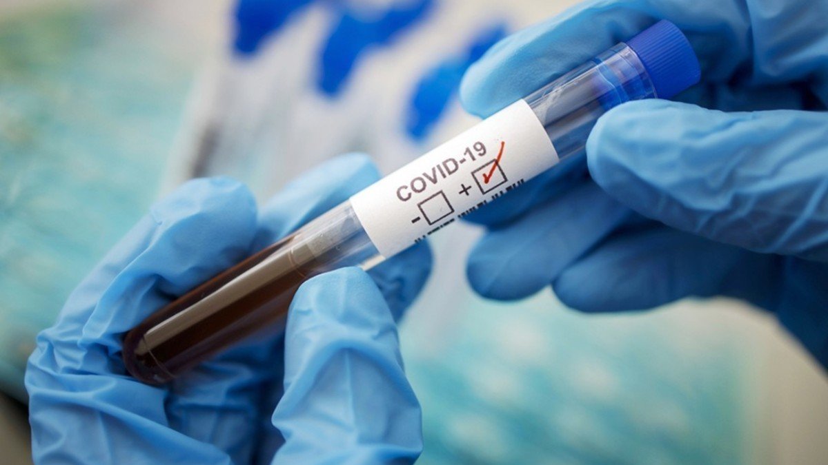 В Запорожской области от осложнений коронавируса умерли 7 человек