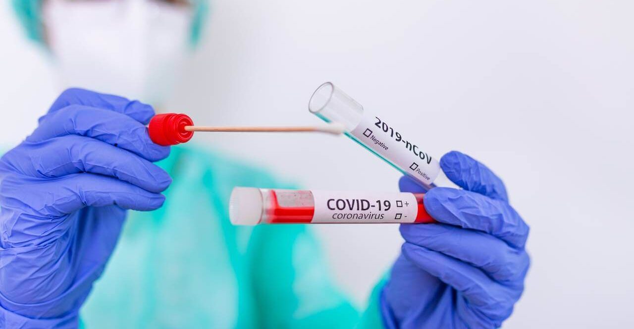 Заболеваемость COVID-19 в Запорожской области: за сутки 669 новых случаев
