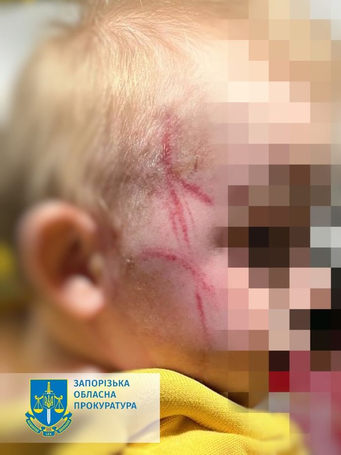 Многодетную мать в Запорожье подозревают в пытках малолетнего сына